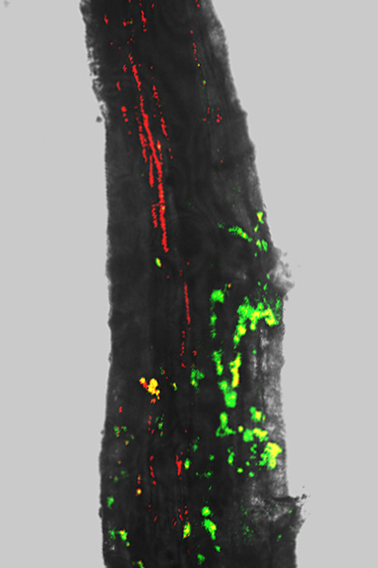 Tree roots recruit beneficial bacteria during drought. Fluorescence and bright-field imaging reveals that during drought (left) a tree root is more densely colonized by two beneficial bacteria (green and red) than after irrigation (right)