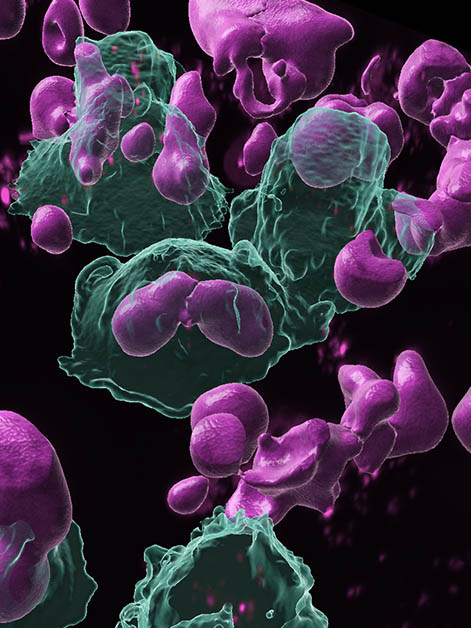 Scavenger cells (green) engulf activated B cells (pink), thereby suppressing local immune response. The cells were imaged in three dimensions using a confocal microscope
