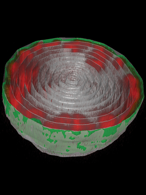 גרעין התא של רימת זבוב הפירות. שרשראות הדי-אן-אי (באדום) צמודות למעטפת הגרעין (בירוק)