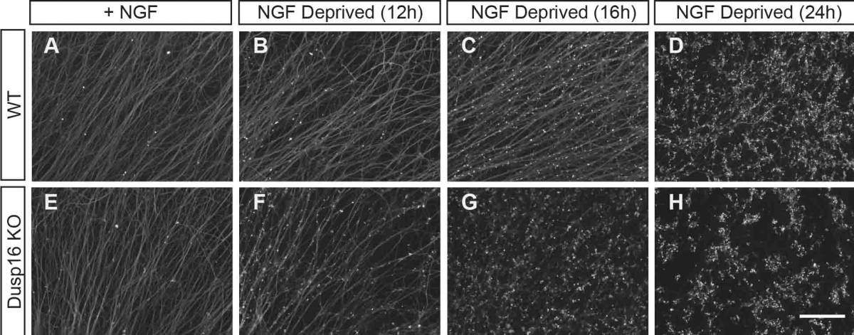 הרחקת גורמי גידול (NGF) מהמצע גורמת לפירוק עצבי של תאי עצב חסרי Dusp16 בשלב מוקדם יותר ובקצב מהיר יותר (שורה תחתונה); לעומת תאי העצב המקוריים (שורה עליונה), כפי שאפשר לראות בדגם הלא-רציף של צביעת האקסונים