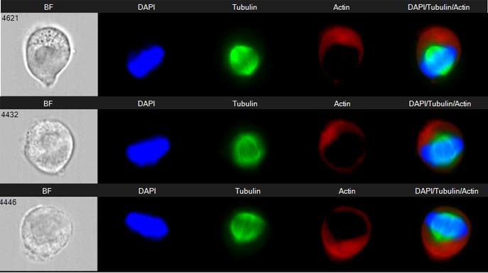 תאי HeLa בחלוקה, מסומנים למרכיבים של שלד התא, אקטין (אדום) וטובולין (ירוק), ועבור DNA (כחול). בטור הימני, המראה את שלושת הצבעים יחד, מופיעים סיבי הטובולין המושכים את הכרומוזומים בזמן חלוקת התא לשני תאי בת. 
