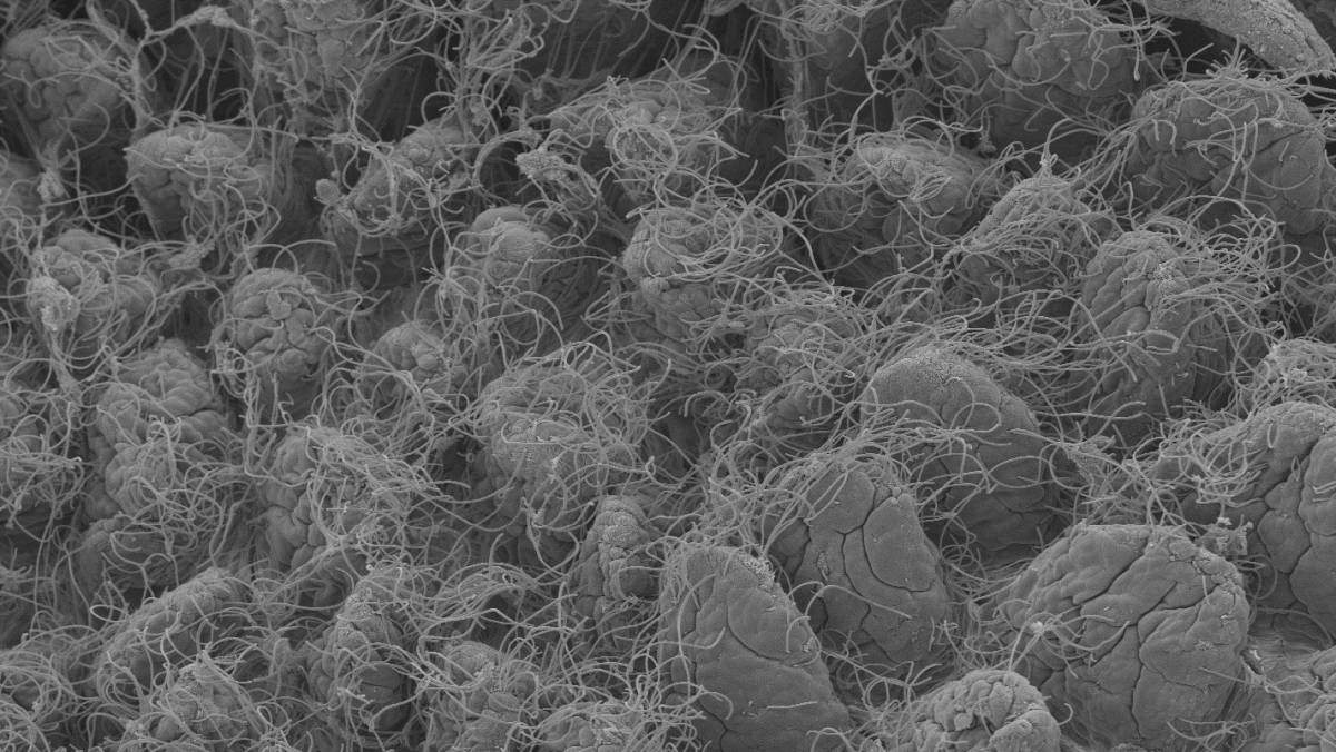 בני מעיים. חיידקים דמויי חוטים בחלל המעי של עכבר כפי שהם נראים תחת מיקרוסקופ אלקטרונים