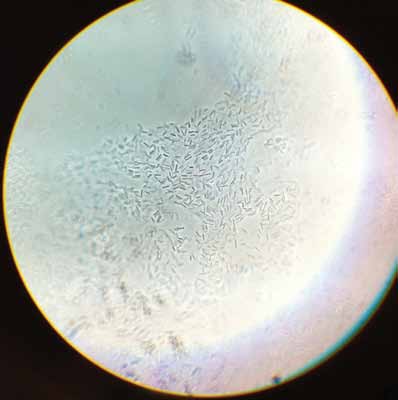 Clostridium acetobutylicum, also known as Weizmann’s organism. Dr. Chaim Weizmann, who died 60 years ago this year, discovered this bacterium and developed a method of using it to ferment acetone from maize starch. Nowadays, biofuels research supported by the Helmsley Charitable Trust is improving on the digestion machinery of Clostridium acetobutylicum and closely related bacteria for breaking down plant-based waste materials into fuel