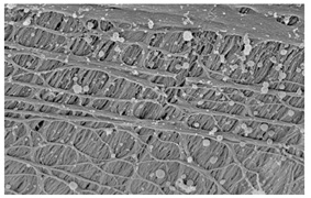קרום השמיעה, כפי שהוא נראה במיקרוסקופ אלקטרונים (מימין)