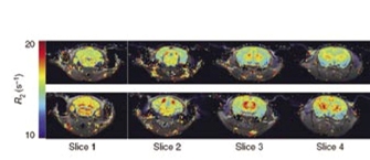 פעילות הגן המדווח פריטין בתאי אנדותל המדפנים את כלי הדם במוח של עכברים בוגרים. חתכים מאזורים שונים במוח עכברים הנושאים את הגן המדווח (בשורה התחתונה) מראים פעילות גבוהה יותר של חלבון הפריטין (המתבטאת בצבעים אדומים יותר) בהשוואה לאזורים אלה בעכברים שאינם מבטאים את הגן המדווח (בשורה העליונה)