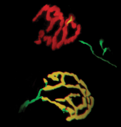 צביעה של אזורי המפגש בין תאי עצב (ירוק) לשריר (אדום). הצביעה הצהובה מייצגת חפיפה מלאה בין תאי העצב לשריר בעכברים נורמליים (למטה). בעכברים מהונדסים, החסרים מיקרו-אר-אן-אי בתאי עצב המעצבבים שרירים, ניכרת צביעת השריר בלבד (למעלה, באדום), משום שהעצב באיזור המפגש חולה