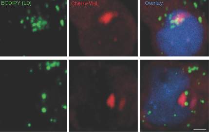 Also in human cells: Inclusion bodies (red) are surrounded by lipid droplets (green)