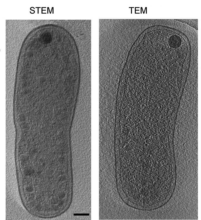 Sub-cellular structures of the common soil bacterium Agrobacterium tumefaciens are visible in greater detail using the new STEM technique (left) than by traditional TEM-based cryo-tomography (right) Scalebars = 200 nm
