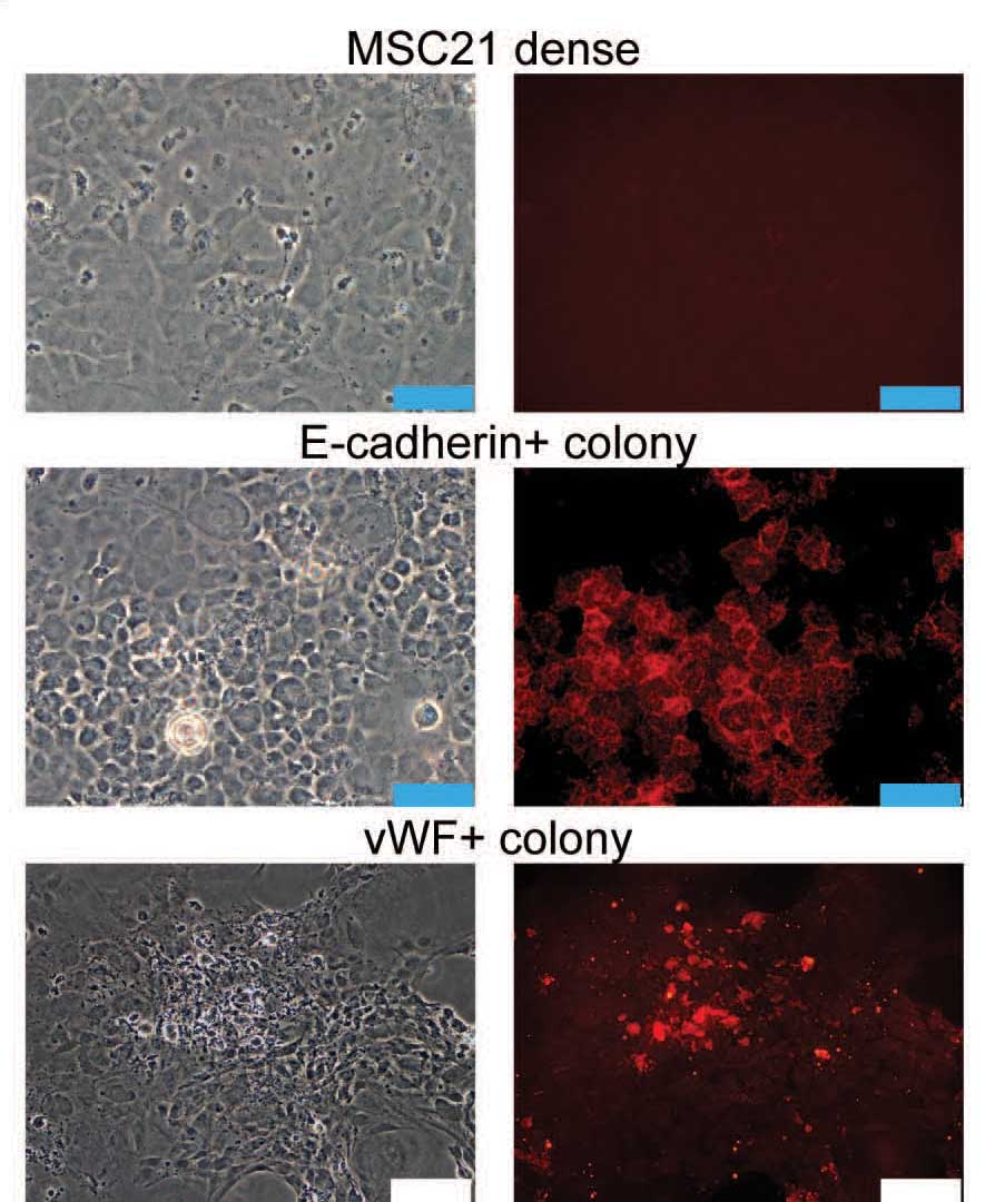 Mesenchymal stem cells (MSCs) seeded densely and sparsely. Left column: phase contrast images; right column: staining with antibodies to either epithelial (E-cahedrin) or endothelial (vWF) markers. (Top) Dense seeding: The cells exhibit random morphology and are negative for the two markers. (Middle) Cells grown from isolated colonies: These develop “cuboidal” shapes typical of epithelial cells and are positive for E-cahedrin. (Bottom) Other sparsely-seeded cells take on elongated shapes and are positive for vWF, the endothelial marker