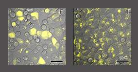 Ubiquitin, labeled with a fluorescent marker (yellow), has been successfully delivered into cells. It is viewed under a confocal fluorescence microscope at two different stages after the delivery process