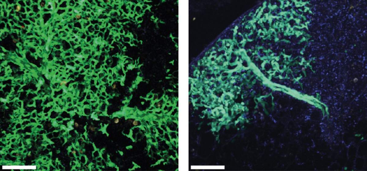 השוואה בין מצב הריאה לאחר שישה שבועות ממועד השתלת תאי הגזע (מימין), לבין התפתחותה לאחר 16 שבועות (משמאל). בירוק: תאים שמקורם בתאי הגזע המושתלים על רקע תאי הריאה של המושתל, שאינם ירוקים. התמונות מראות היווצרות מתמשכת של תאי ריאה חדשים, המחליפים את התאים שניזוקו. צילום באמצעות מיקרוסקופ 2-Photon 