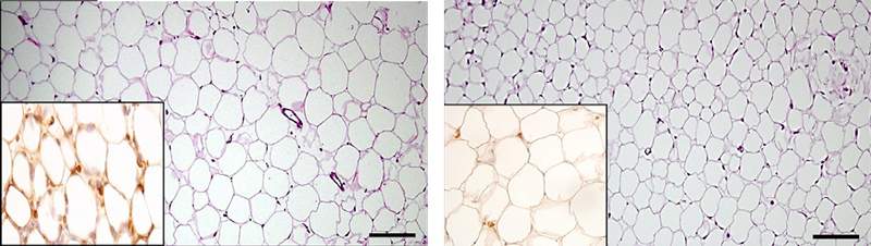  תאי רקמת השומן מוגדלים ומסודרים פחות מהרגיל בעכברים חסרי תאים דנדריטיים עתירי פרפורין (למעלה), לעומת אותה רקמה בעכברים רגילים (למטה). בתמונה הקטנה למטה משמאל: מבנים דמויי כתר בתוך רקמת השומן (למעלה, חום כהה) מצביעים על תהליך דלקתי מוגבר בתוך הרקמה