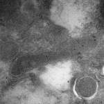 תא חיידק (מאורך, במרכז התמונה) בתוך תא של סרטן מוח מסוג גליובלסטומה, כפי שנראה מבעד למיקרוסקופ אלקטרונים. הנקודות השחורות בתא החיידק – נוגדנים מהונדסים שנושאים חלקיקי זהב ונקשרים באופן ממוקד לרכיב הקיים רק במעטפת התא של חיידקים ולא בתאים אנושיים