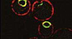 צילום פלורסנטי של תאי שמרים, המראה שחלבון השמרים Ypf1 (בירוק) מצוי מסביב לגרעין התא, בדומה לפרסנילין, החלבון האנושי המקביל לו, שגורם למחלת אלצהיימר