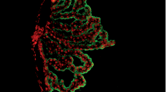 צילום באמצעות מיקרוסקופ אימונו-פלורסנטי של אפיתל מקלעת הדמים, הממוקם בחדרי המוח. אפיתל מקלעת הדמים משמש כממשק חיסוני בין הדם לבין המוח, ומשפיע על הפעילות המוחית לאורך החיים
