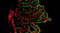 צילום באמצעות מיקרוסקופ אימונו-פלורסנטי של אפיתל מקלעת הדמים, הממוקם בחדרי המוח. אפיתל מקלעת הדמים משמש כממשק חיסוני בין הדם לבין המוח, ומשפיע על הפעילות המוחית לאורך החיים. בירוק: תאי האפיתל; באדום: חלבוני כימוקין בשם CXCL10
