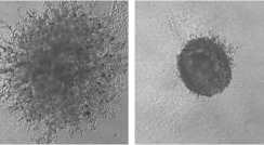  מיקבץ של כ-5,000 תאים גרורתיים של סרטן השד. שלוחות תאיות שנוצרות (משמאל) מאפשרות לתאים להתפזר בדומה לתהליך של התפשטות גרורות בגוף החולה; כאשר מוסיפים מולקולה קטנה הבולמת את פעילותו של הגן SYNJ2 נמנעת היווצרותן של השלוחות הפולשניות (מימין). צולם באמצעות מיקרוסקופ אור 