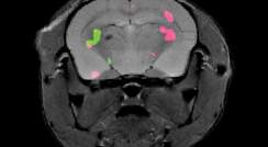 סריקת MRI של מוח עכבר מציגה בעזרת שני צבעים ביטוי של שני חלבונים שונים