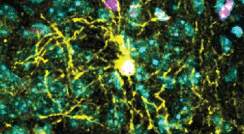 תא מסוג אוליגודנדרוציט על שלל שלוחותיו (בצהוב) במקטע מוח של עכבר. מגיב ללחץ באופן שונה לגמרי בזכרים ובנקבות