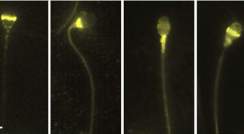 תאי זרע מנווטים את דרכם באמצעות חלבוני ראייה