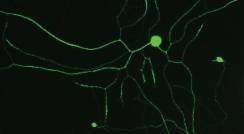 תאי עצב של עכבר החסרים את החלבון אימפורטין-בטא-1