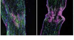 כמויות גדולות של החלבון mTOR (סגול-אדום) מופיעות במהירות בעצב השת לאחר פציעה (שלוש תמונות מימין); בעצב שאינו פצוע (משמאל) לא נמצא חלבון זה בכמויות כאלה