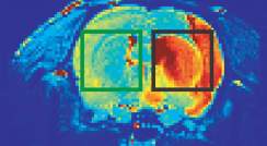 הדמיה באמצעות תהודה מגנטית של מוח חולדה, בו נגרם שבץ בחלקו הימני (מסגרת שחורה); חלקו השמאלי לא נפגע (מסגרת ירוקה)