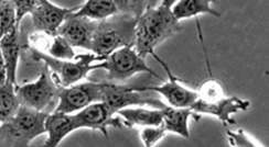 תאי סרטן השד בתרבית כפי שהם נראים תחת מיקרוסקופ אופטי. אפשר להבחין ברצועות המחברות בין התאים 