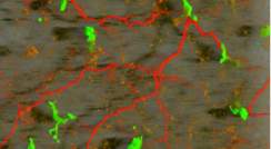 מקרופאגים (בירוק) ואקסונים (באדום) ברקמת שומן חום. צולם באמצעות מיקרוסקופיה דו-פוטונית