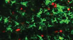 בבלוטת לימפה בריאה, תאים דנדריטיים (בירוק) יוצרים רשתות שבהן נודדים תאי ה-T (באדום). צילום: מעבדתו של ד"ר גיא שחר