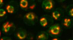 מיטוכונדריה (אדום) המתאספות סביב גרעין התא (ירוק) כפי שנצפה תחת מיקרוסקופ פלואורסצנטי 