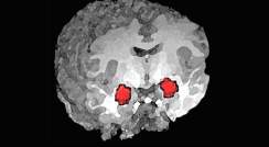 האמיגדלה (באדום) – מבנה מוחי דמוי שקד הנמצא בעומק האונה הרקתית של יונקים רבים, ובהם האדם. מעורבת בתהליכי למידה אסוציאטיבית שבהם נוצרת זיקה בין קלט חושי מסוים לחוויות חיוביות או שליליות