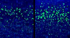 חתך מקליפת המוח של עובר עכבר בן 18 יום מקבוצת הביקורת (שמאל) ומהקבוצה שנחשפה לתגובת המערכת החיסונית של האם (ימין). בירוק – תאי השכבה החמישית שבקליפת המוח (CTIP2), המיוצרים בעודף בקבוצה שנחשפה לתגובה החיסונית. קנה מידה: 20 מיקרומטר