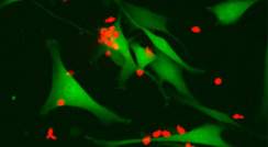תאי T של המערכת החיסונית (באדום) תוקפים תאי סרטן מסוג מלנומה (בירוק). תאי T ש"יודעים" לקרוא "תמרורים" על גבי התאים הסרטניים יעילים במיוחד בהשמדתם