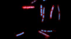 חיידקי אי-קולי שהודבקו בפאג'ים