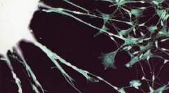 תאי גזע שעברו תיכנות מחדש באמצעות אר-אן-אי (RiPS) מגדלים שלוחות ארוכות האופייניות לתאי עצב, לאחר העברתם למשטח גידול חדש