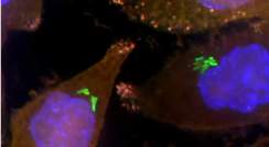 חיידקים בתוך תאי סרטן הלבלב