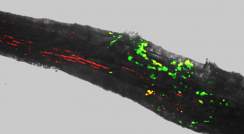 שני מינים של חיידקי אדמה ידידותיים (מסומנים בירוק ובאדום) הניזונים משורשי ברושים. ניתן לראות כי החיידקים מאכלסים בצפיפות גדולה יותר את השורש שגדל בתנאי בצורת (משמאל) בהשוואה לשורש שזכה להשקיה (מימין)