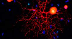 תמונת מיקרוסקופיה קונפוקלית של תאי עצב תחושתיים של מערכת העצבים ההיקפית בתרבית 