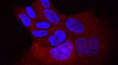 תאי סרטן ריאות אנושיים עם המוטציה L858R בגן EGFR. בכחול – גרעיני התאים. באדום – חלבון המופיע בנוזל התא כאשר קולטני EGFR פעילים ודוחפים את התא לחלוקה בלתי-מבוקרת