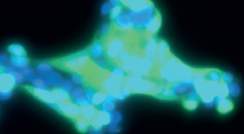 צילום מיקרוסקופי של תאי ריאה אנושיים בתרבית שהודבקו בנגיף הקורונה. מסומנים בכחול (משמאל) - גרעיני התאים, בירוק (במרכז) – הנגיף, בטורקיז (מימין) – התאים שהודבקו בנגיף