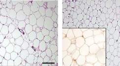 תאי רקמת השומן מוגדלים ומסודרים פחות מהרגיל בעכברים חסרי תאים דנדריטיים עתירי פרפורין (למעלה), לעומת אותה רקמה בעכברים רגילים (למטה). תמונה קטנה למטה משמאל: מבנים דמויי כתר בתוך רקמת השומן (למעלה, חום כהה) מצביעים על תהליך דלקתי מוגבר בתוך הרקמה