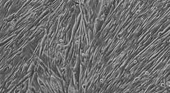 צילום במיקרוסקופ של תאי שריר של עכברים