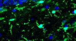 מיקרוגליה (בירוק בהיר) במוח עכבר בוגר. צולם באמצעות מיקרוסקופ פלואורסצנטי
