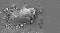 תצלום מיקרוסקופ אלקטרונים של תאים אפקטורים המחדירים רגליים דרך הקרום של תאי אנדותל
