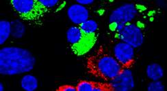 תאים מתוכנתים מחדש: תאי בטא המייצרים אינסולין (מסומן בירוק) ו"קרובי משפחתם" – תאי דלתא המייצרים סומטוסטטין (מסומן באדום). תאים המתוכנתים מחדש מכילים לרוב שני גרעינים (מסומנים בכחול) – עדות לכך שהם במקורם תאים אקסוקריניים
