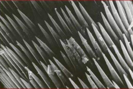 Needles of an Ascidian