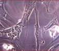 Epithelial cells in culture