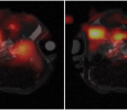 SPENmr\ Ultrafast spatiotemporally-encoding: A superior approach to cancer diagnosis by non-invasive diffusion-weighted MRI