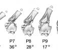 kiNESIS\ NovEl Strategies for treatIng tendon-to-bone injurieS - kiNESIS